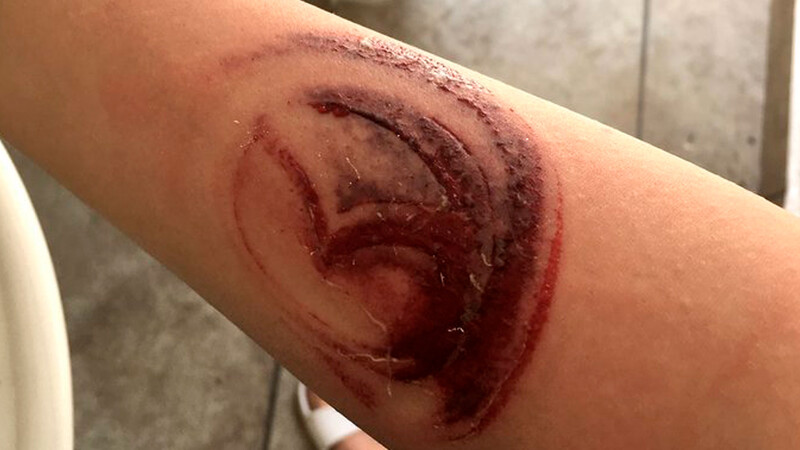 Tras choque se le queda tatuado el logo de Mazda y busca patrocinio
