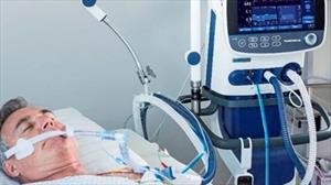 Grupo PSA construye 50,000 ventiladores por el Coronavirus